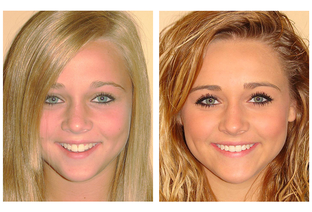 Dental Group of Millburn