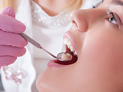 Dental Fillings in Short Hills